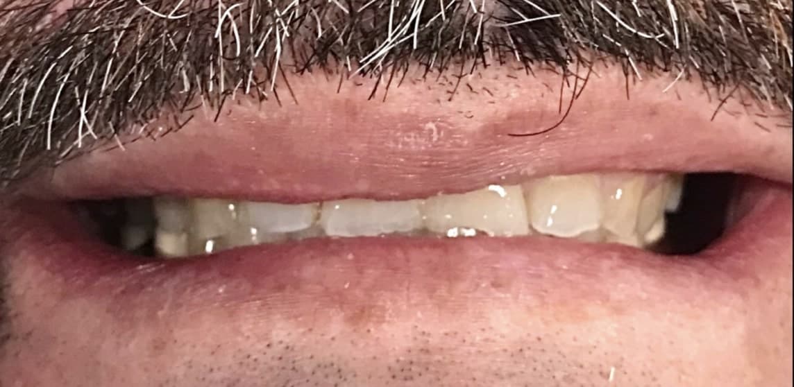 Before dental treatment