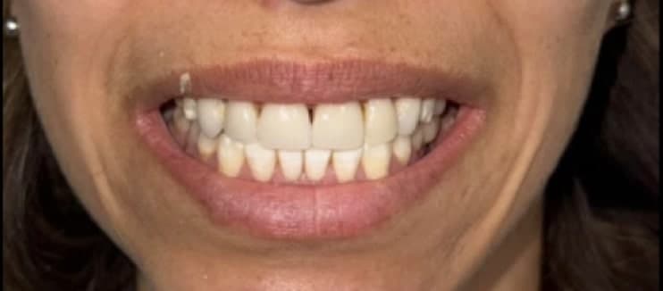 Before dental treatment