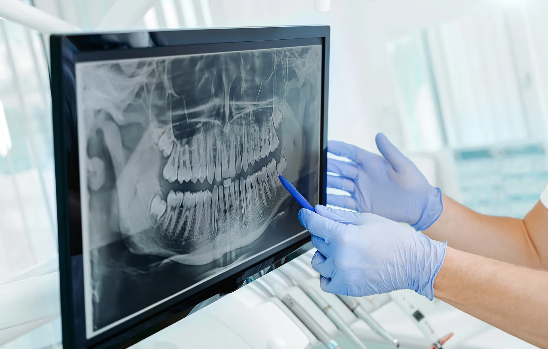 Virtual smile consultation technology