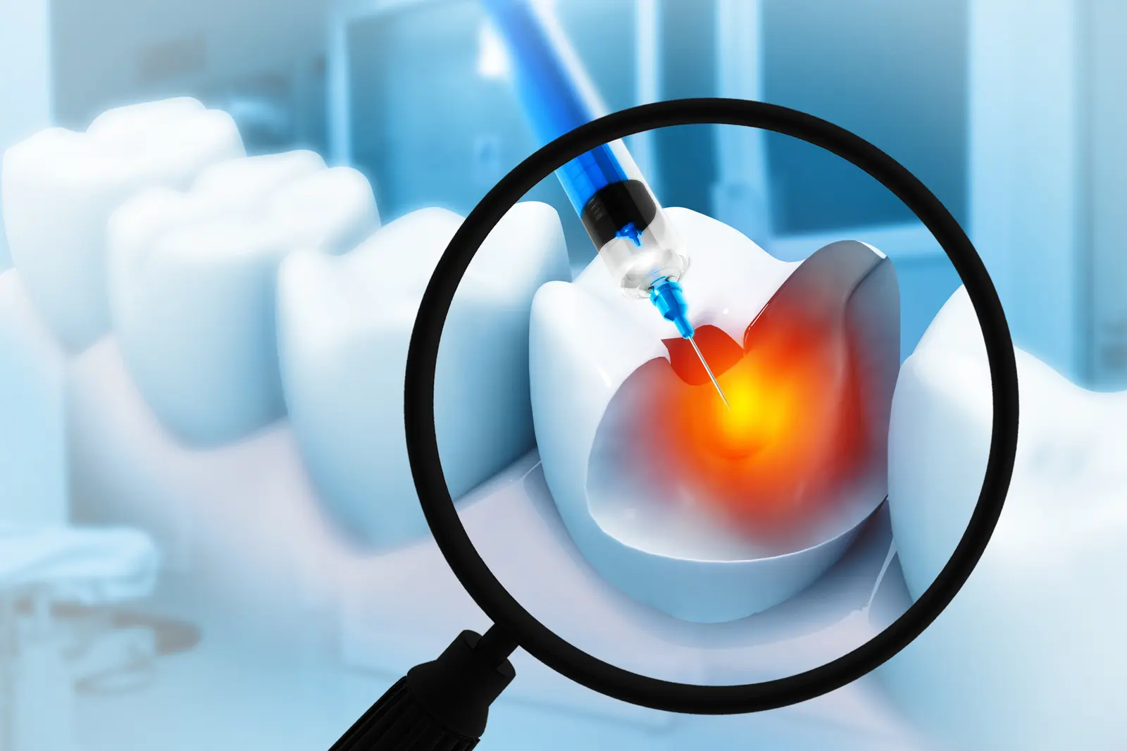 Sedation Dentistry