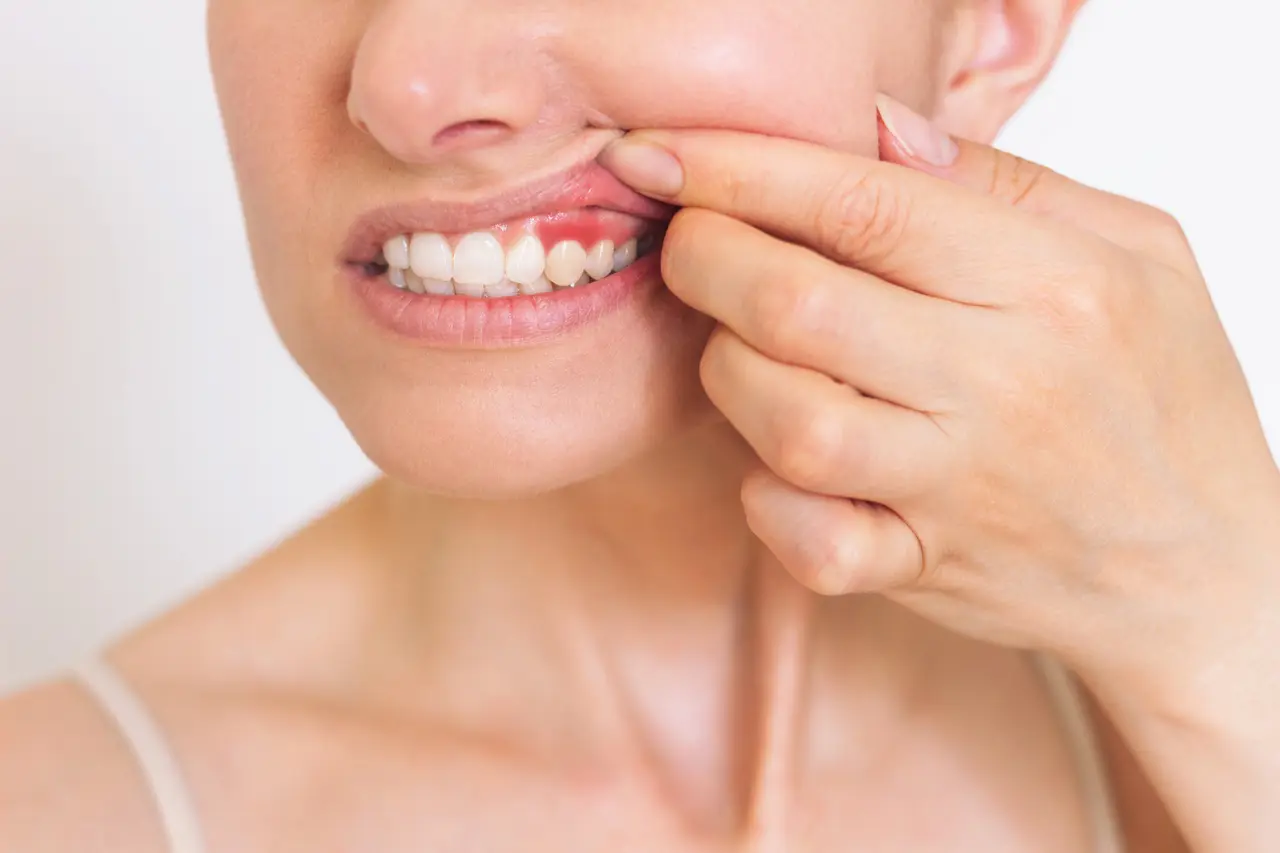 Periodontal treatment