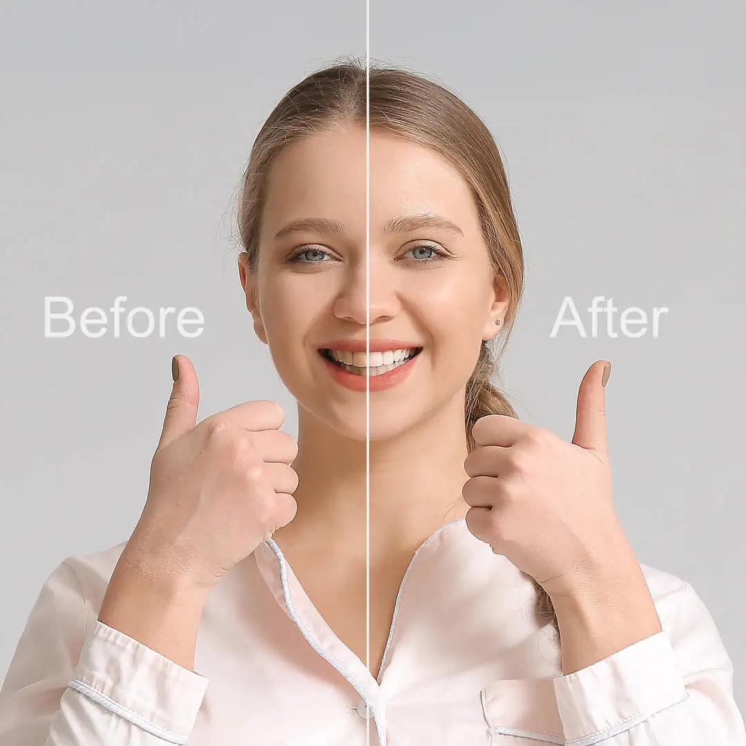 Smile Makeovers
